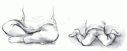 Иллюстрация к книге — Игры и занятия с особым ребенком. Руководство для родителей [i_046.jpg]