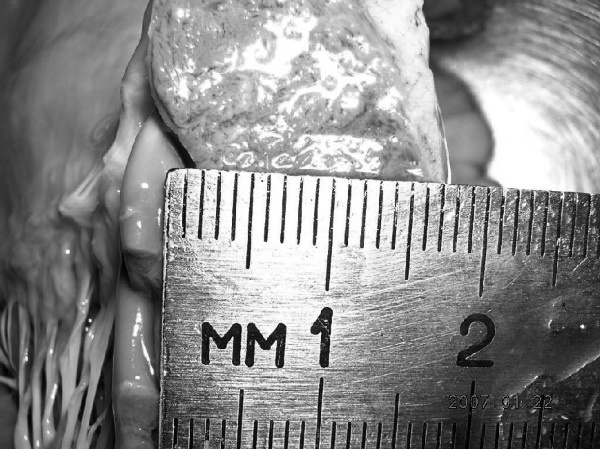 Иллюстрация к книге — Маломобильный пациент [i_044.jpg]