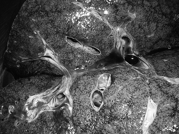 Иллюстрация к книге — Маломобильный пациент [i_045.jpg]