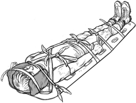 Иллюстрация к книге — Первая помощь своими руками. Если скорая не спешит [i_038.jpg]