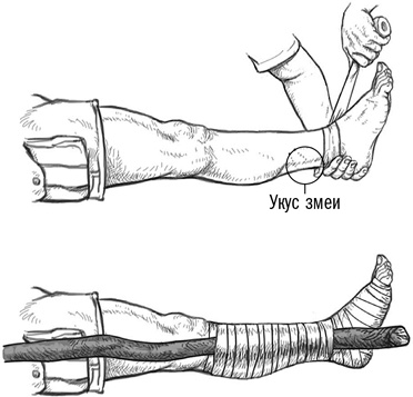 Иллюстрация к книге — Первая помощь своими руками. Если скорая не спешит [i_043.jpg]