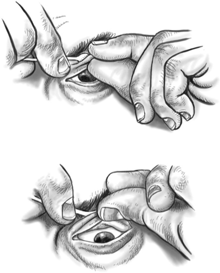 Иллюстрация к книге — Первая помощь своими руками. Если скорая не спешит [i_047.jpg]