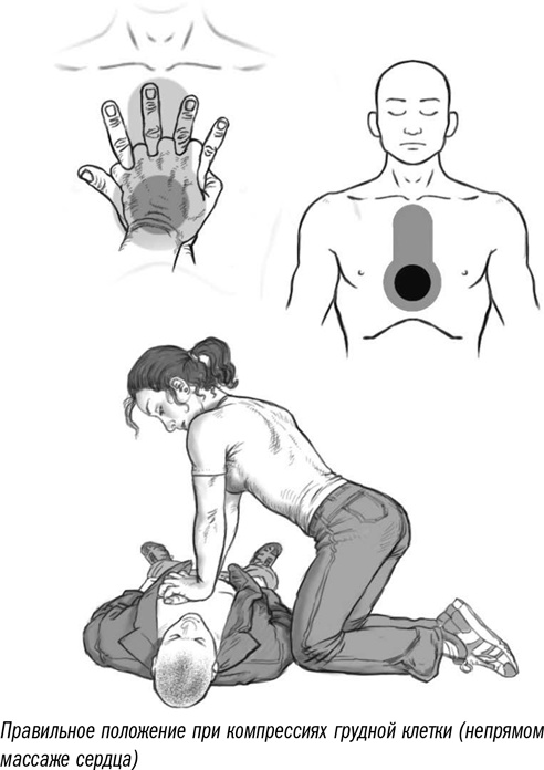 Иллюстрация к книге — Первая помощь своими руками. Если скорая не спешит [i_058.jpg]