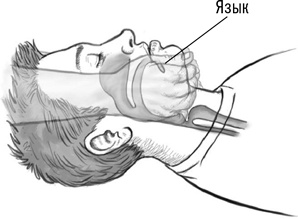 Иллюстрация к книге — Первая помощь своими руками. Если скорая не спешит [i_064.jpg]