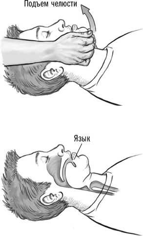 Иллюстрация к книге — Первая помощь своими руками. Если скорая не спешит [i_065.jpg]