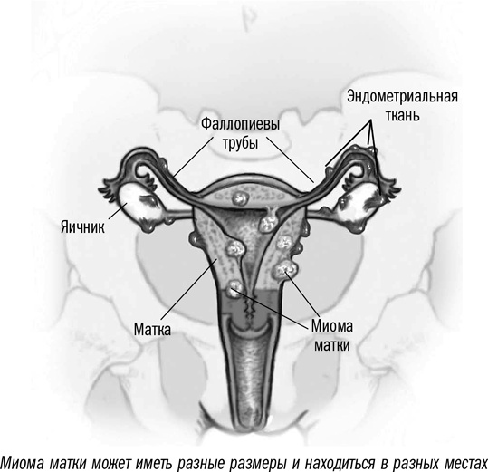 Иллюстрация к книге — Первая помощь своими руками. Если скорая не спешит [i_081.jpg]