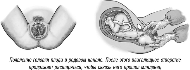 Иллюстрация к книге — Первая помощь своими руками. Если скорая не спешит [i_083.jpg]