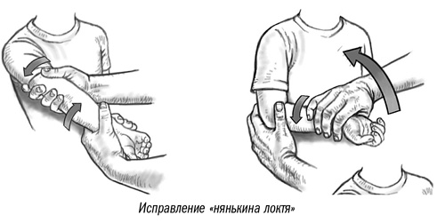 Иллюстрация к книге — Первая помощь своими руками. Если скорая не спешит [i_089.jpg]