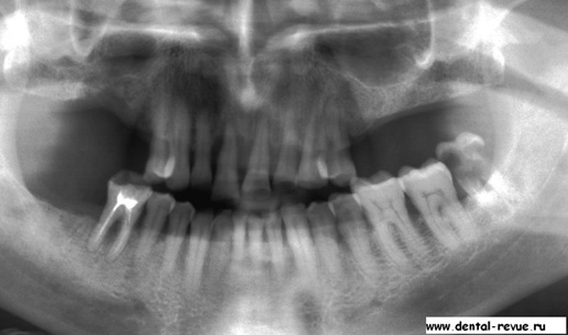 Иллюстрация к книге — Судьба педераста или непридуманные истории из жизни… [i_001.jpg]