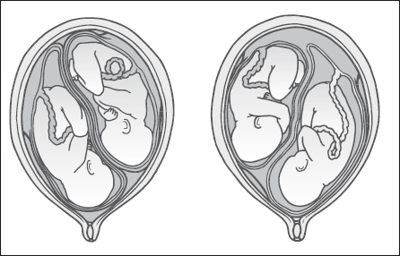 Иллюстрация к книге — Самая важная российская книга мамы. Беременность. Роды. Первые годы [i_048.jpg]