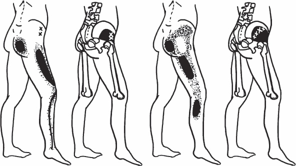 Иллюстрация к книге — Благодарный позвоночник. Как навсегда избавить его от боли. Домашняя кинезиология [_09.jpg]