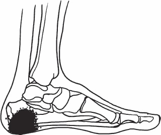 Иллюстрация к книге — Благодарный позвоночник. Как навсегда избавить его от боли. Домашняя кинезиология [_13.jpg]