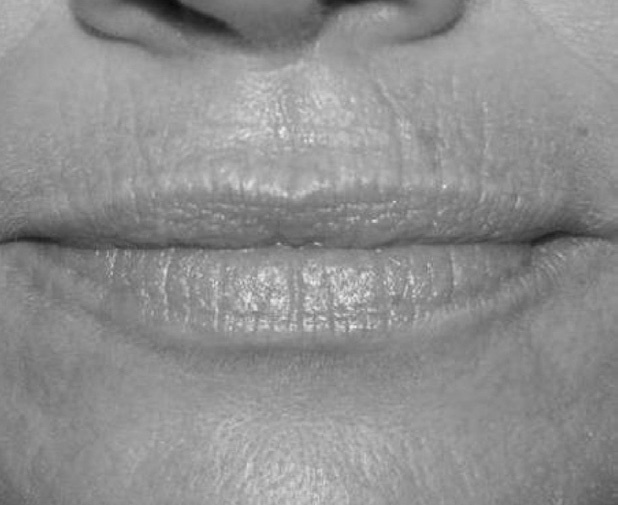 Иллюстрация к книге — Читай лица! Специальная методика чтения лиц и эмоций [i_265.jpg]