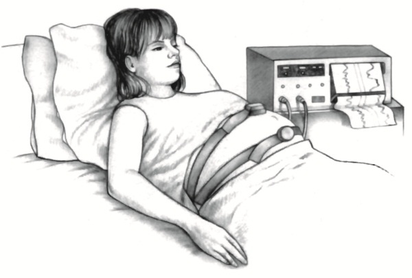 Иллюстрация к книге — В ожидании малыша (обновленное издание) [i_087.jpg]