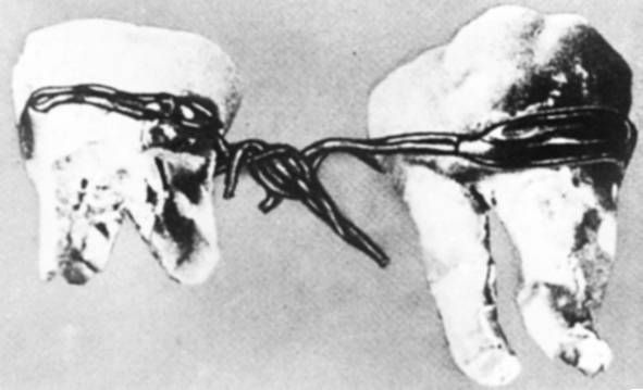 Иллюстрация к книге — Из истории зубоврачевания, или Кто лечит зубы монархам [i_026.jpg]