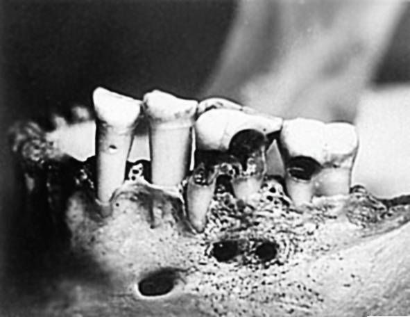 Иллюстрация к книге — Из истории зубоврачевания, или Кто лечит зубы монархам [i_028.jpg]