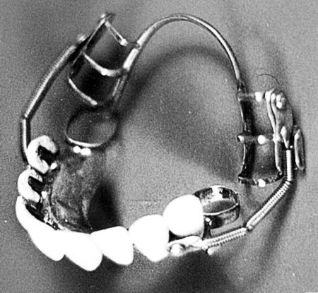 Иллюстрация к книге — Из истории зубоврачевания, или Кто лечит зубы монархам [i_063.jpg]