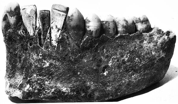 Иллюстрация к книге — Из истории зубоврачевания, или Кто лечит зубы монархам [i_065.jpg]