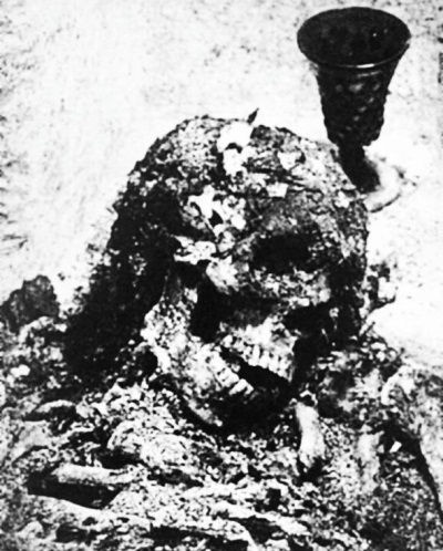 Иллюстрация к книге — Из истории зубоврачевания, или Кто лечит зубы монархам [i_099.jpg]