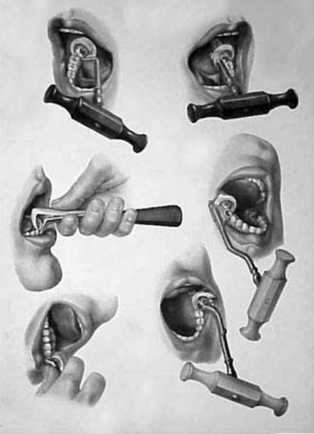 Иллюстрация к книге — Из истории зубоврачевания, или Кто лечит зубы монархам [i_261.jpg]