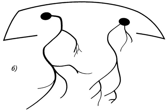 Иллюстрация к книге — Вся фигня - от мозга?! Простая психосоматика для сложных граждан [i_026.jpg]