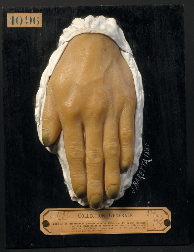 Иллюстрация к книге — Жертвы моды. Опасная одежда прошлого и наших дней [b00000462.jpg]