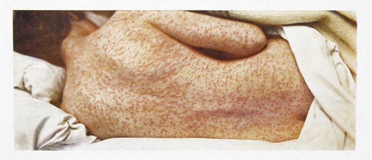 Иллюстрация к книге — Жертвы моды. Опасная одежда прошлого и наших дней [b00000500.jpg]