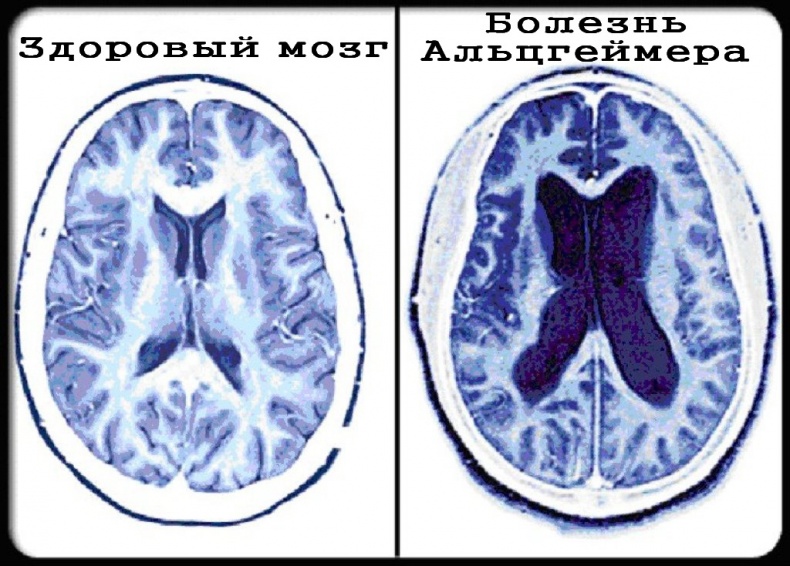 Иллюстрация к книге — Теломераза. Как сохранить молодость, укрепить здоровье и увеличить продолжительность жизни [i_027.jpg]