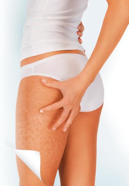 Иллюстрация к книге — Как избавиться от боков, &quot;ушей&quot; и &quot;галифе&quot; [i_004.jpg]