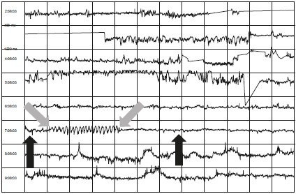 Иллюстрация к книге — Сверхъестественный разум. Как обычные люди делают невозможное с помощью силы подсознания [i_047.jpg]