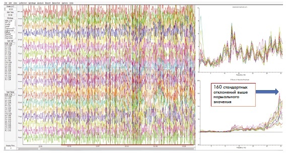 Иллюстрация к книге — Сверхъестественный разум. Как обычные люди делают невозможное с помощью силы подсознания [i_093.jpg]
