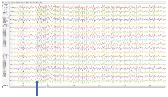 Иллюстрация к книге — Сверхъестественный разум. Как обычные люди делают невозможное с помощью силы подсознания [i_096.jpg]