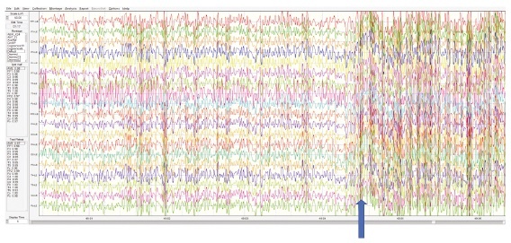 Иллюстрация к книге — Сверхъестественный разум. Как обычные люди делают невозможное с помощью силы подсознания [i_103.jpg]