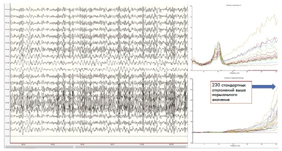 Иллюстрация к книге — Сверхъестественный разум. Как обычные люди делают невозможное с помощью силы подсознания [i_115.jpg]