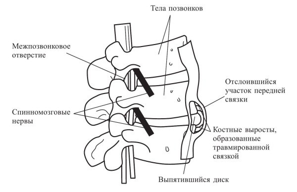 Иллюстрация к книге — Практический курс здоровья для вашего позвоночника [i_061.jpg]