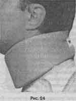 Иллюстрация к книге — Победить боль в спине [i_018.jpg]