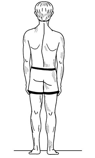 Иллюстрация к книге — Жизнь без боли в спине. Лечение сколиоза, остеопороза, остеохондроза, межпозвонковой грыжи без операции [i_015.jpg]