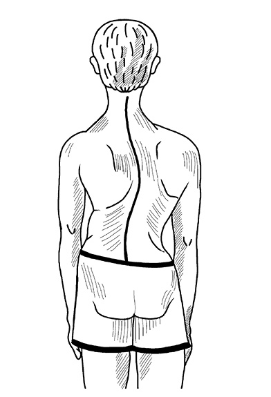 Иллюстрация к книге — Жизнь без боли в спине. Лечение сколиоза, остеопороза, остеохондроза, межпозвонковой грыжи без операции [i_053.jpg]