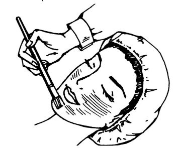 Иллюстрация к книге — Омоложение. Краткая энциклопедия [i_152.jpg]