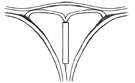 Иллюстрация к книге — Главная книга о женском здоровье [i_031.jpg]