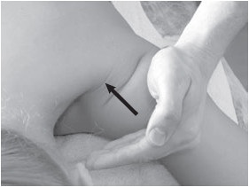 Иллюстрация к книге — Боль в спине. Как определить причину и устранить приступ [i_065.jpg]