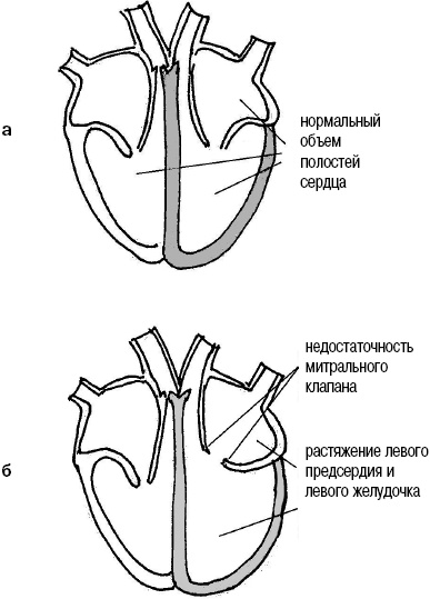 Иллюстрация к книге — Стоп-инфаркт. Как читать ЭКГ и заботиться о сердце [autogen_ebook_id13.jpg]