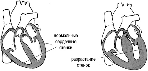 Иллюстрация к книге — Стоп-инфаркт. Как читать ЭКГ и заботиться о сердце [autogen_ebook_id36.jpg]