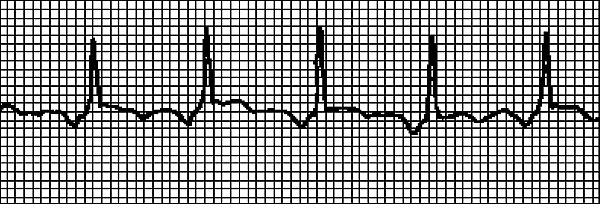 Иллюстрация к книге — Стоп-инфаркт. Как читать ЭКГ и заботиться о сердце [autogen_ebook_id4.jpg]