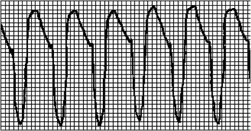 Иллюстрация к книге — Стоп-инфаркт. Как читать ЭКГ и заботиться о сердце [autogen_ebook_id5.jpg]