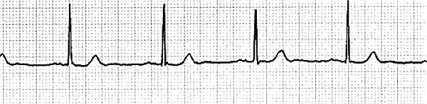 Иллюстрация к книге — Стоп-инфаркт. Как читать ЭКГ и заботиться о сердце [autogen_ebook_id6.jpg]