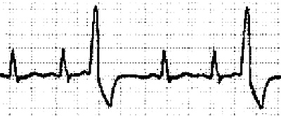 Иллюстрация к книге — Стоп-инфаркт. Как читать ЭКГ и заботиться о сердце [autogen_ebook_id7.jpg]