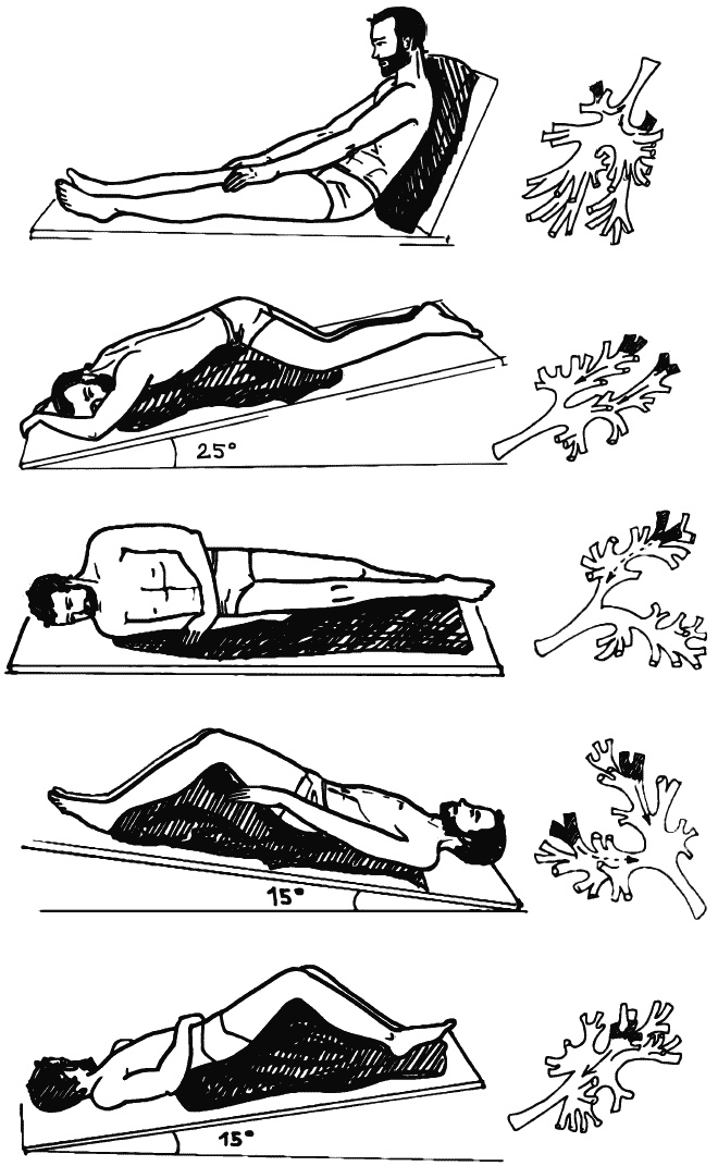 Иллюстрация к книге — Бронхи и легкие. Советы и рекомендации ведущих врачей [_194.jpg]