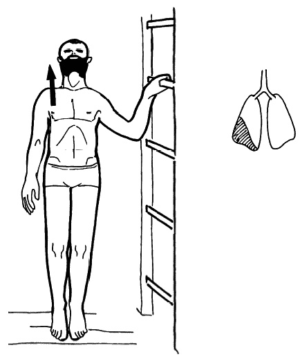 Иллюстрация к книге — Бронхи и легкие. Советы и рекомендации ведущих врачей [_229.jpg]