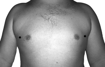 Иллюстрация к книге — Целительные точки для лечения щитовидной железы [autogen_ebook_id11.jpg]